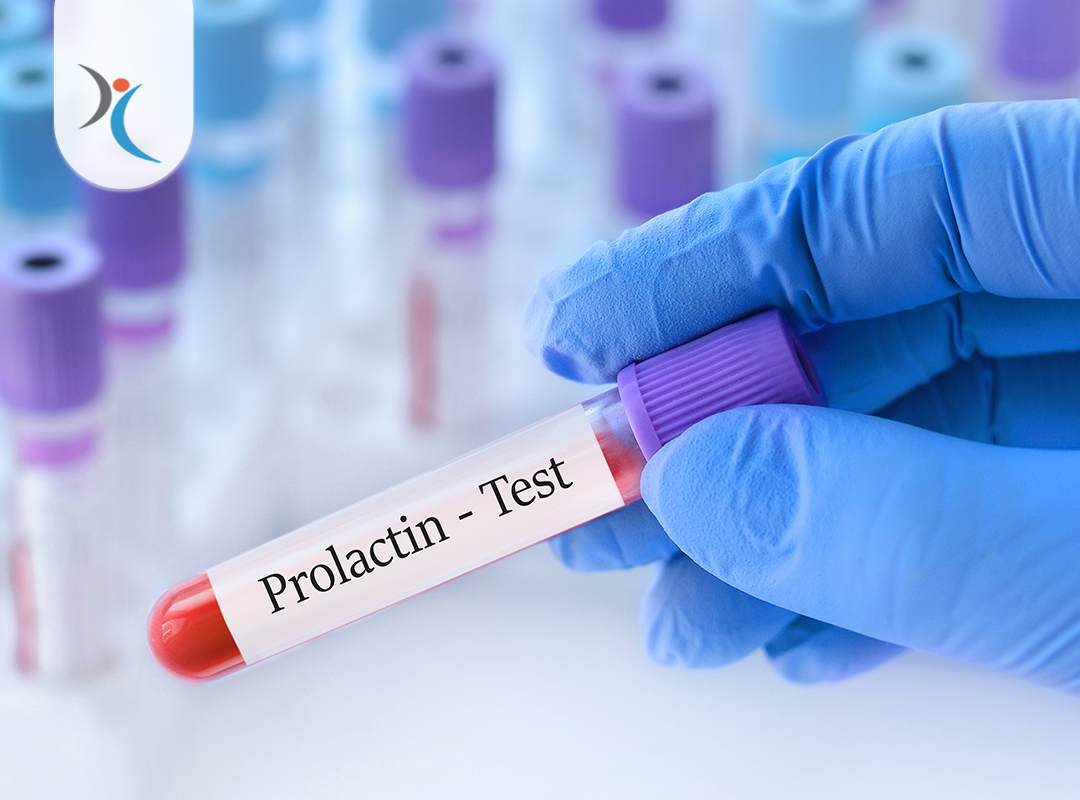 هرمون الحليب